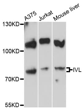 IVL / Involucrin Antibody