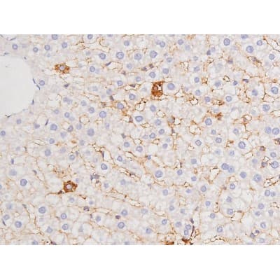 Polyclonal Rabbit anti-Human MAPT / Tau Antibody (phospho-Thr212, IHC, WB)