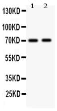MAP3K3 / MEKK3 Antibody (aa11-25)