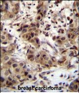 Polyclonal Rabbit anti-Human ZNF816 / ZNF816A Antibody (aa 1-30, N-term, IHC, WB)