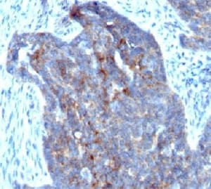 RBP1 / CRBP Antibody (clone RBP/872, Ready-to-Use)
