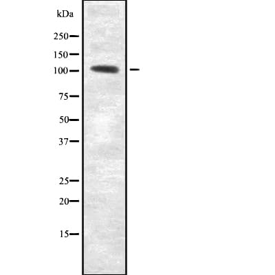 Polyclonal Rabbit anti-Human RECK Antibody (WB)