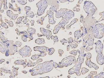 Polyclonal Rabbit anti-Human ACKR2 / CCR10 / D6 Antibody (IHC, WB)