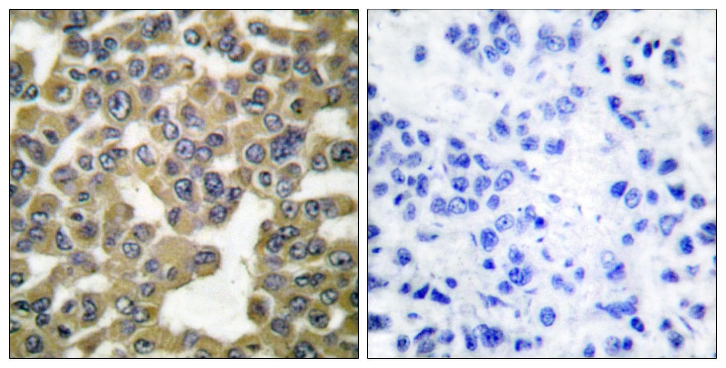 MMP13 Antibody