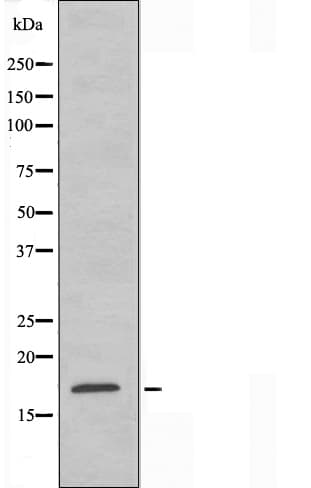 RPS15 / Ribosomal Protein S15 Antibody