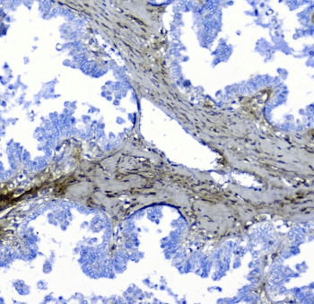 Lumican Antibody