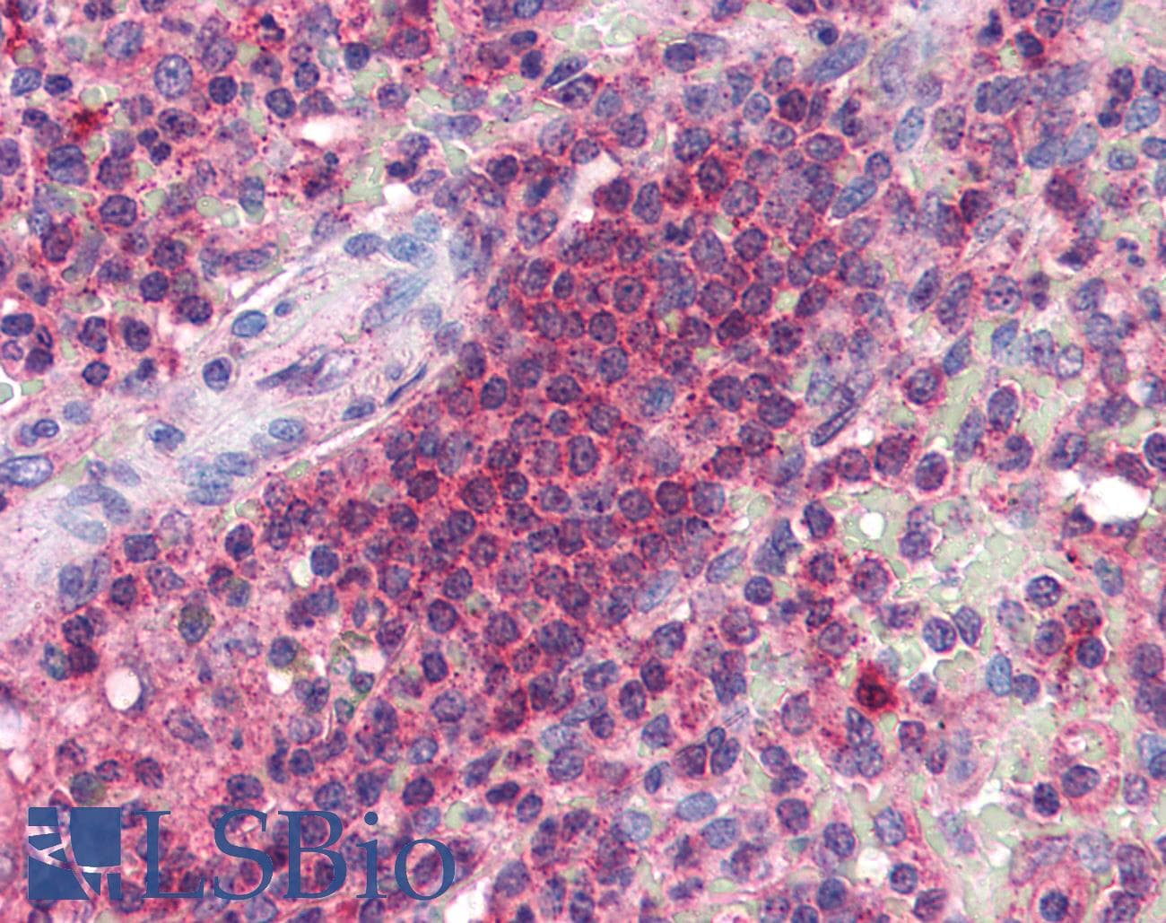 IHC-plus™ CDNF / ARMETL1 Antibody