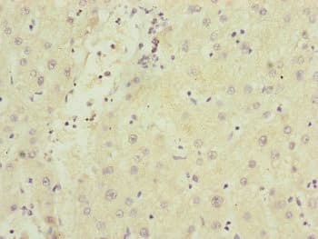 Polyclonal Rabbit anti-Human SAMM50 Antibody (IHC, WB)