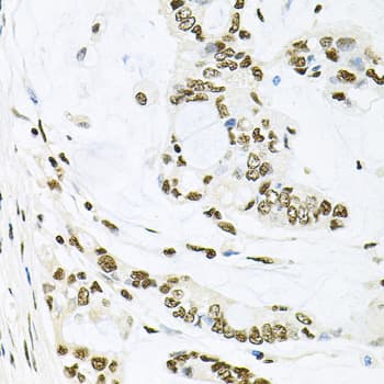Polyclonal Rabbit anti-Human MAPK8 / JNK1 Antibody (IHC, IF, WB)