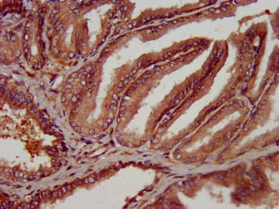 OLFM4 / Olfactomedin 4 Antibody