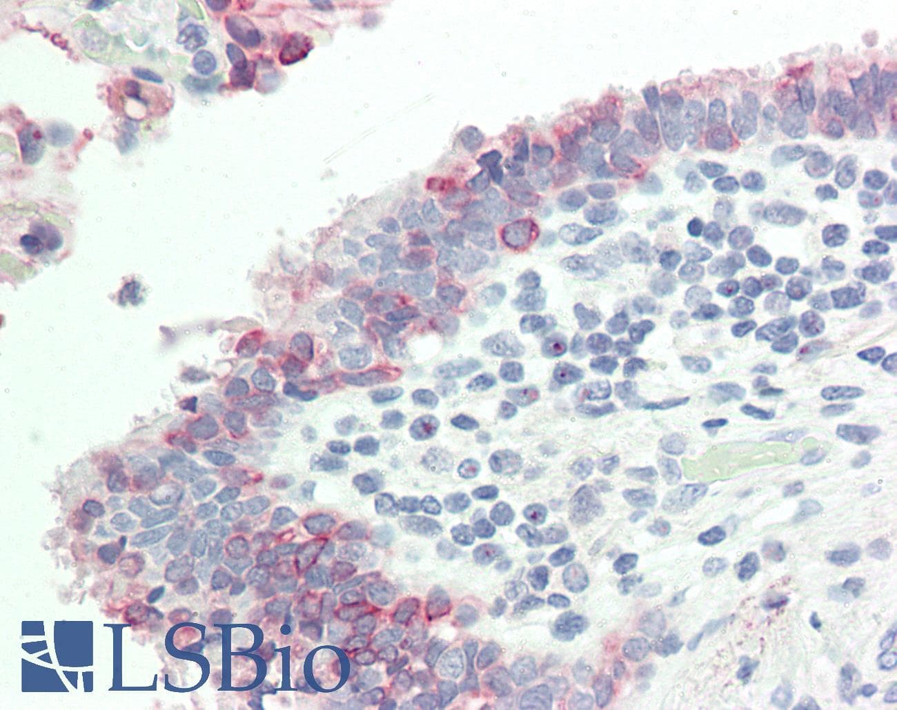Polyclonal Rabbit anti-Human KRT7 / CK7 / Cytokeratin 7 Antibody (N-Terminus, IHC, WB)