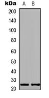 Polyclonal Rabbit anti-Human KDELR2 Antibody (Internal, IHC, IF, WB)