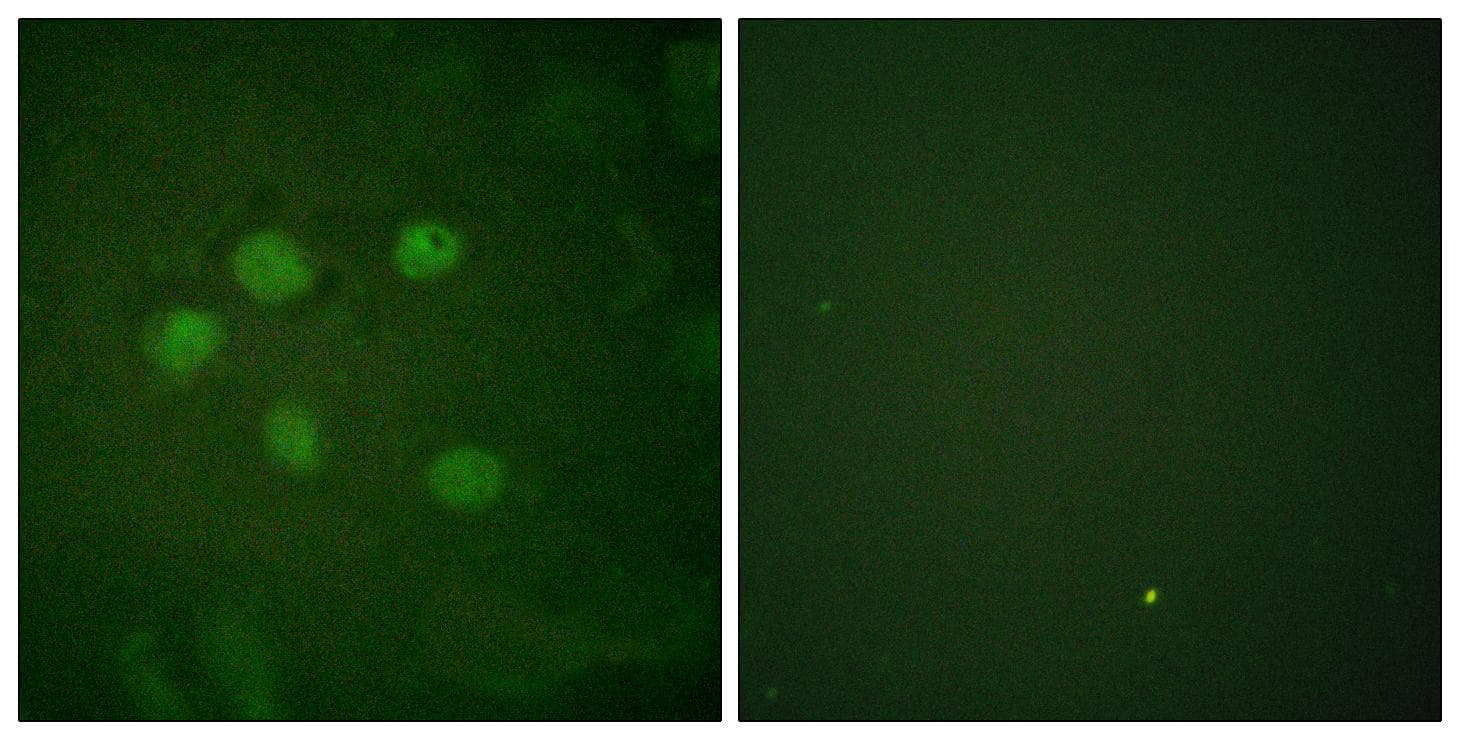 Polyclonal Rabbit anti-Human SAE1 Antibody (IF, WB)