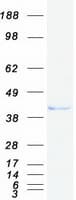 Human KCTD9 Protein (Recombinant Myc-DDK (Flag))