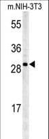 Polyclonal Rabbit anti-Human KCTD21 Antibody (aa232-260, IHC, WB)
