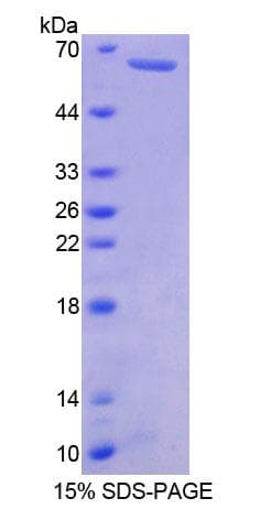 Human MYH7B Protein (Recombinant His-GST)