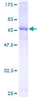 Human AMBP Protein (Recombinant GST)