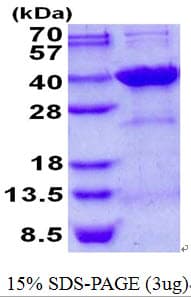 Human SDCBP2 / Syntenin 2 Protein (Recombinant His)