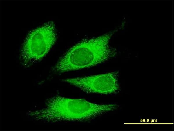 TG / Thyroglobulin Antibody (clone 1G3)