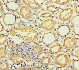 Polyclonal Rabbit anti-Human MRPL21 Antibody