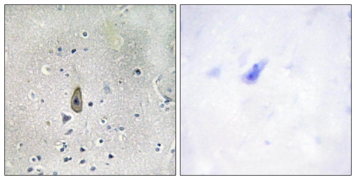 Polyclonal Rabbit anti-Human KCNJ1 / ROMK Antibody (phospho-Ser44/25, IHC, IF)