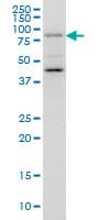 IHC-plus™ GGA1 Antibody (clone 3F11)