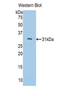 FSCN2 / Retinal Fascin Antibody (aa8-258)