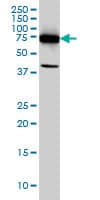 DDX3Y Antibody (clone 2D7)