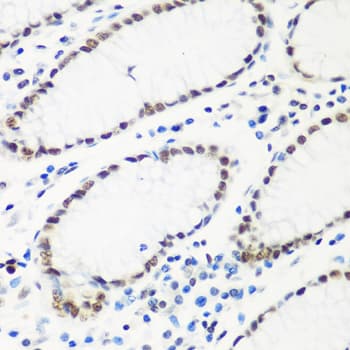 Polyclonal Rabbit anti-Human HTATSF1 / TAT-SF1 Antibody (IHC, WB)