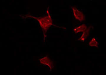 DAB1 Antibody (phospho-Tyr232)