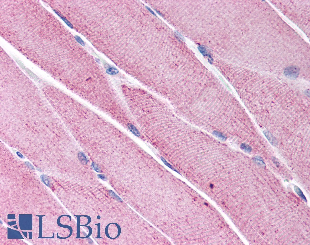 K13 / KCNG Antibody (N-Terminus)