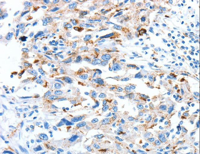 Polyclonal Rabbit anti-Human CLPTM1L / CLPTM1-Like Antibody (IHC)