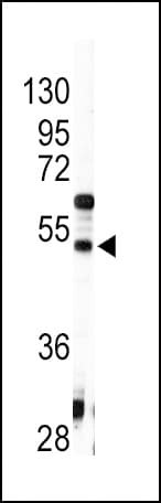 Polyclonal Rabbit anti-Human AGT / Angiotensinogen Antibody (aa418-450, IHC, WB)