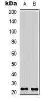Polyclonal Rabbit anti-Human NRTN / Neurturin Antibody (Internal, WB)