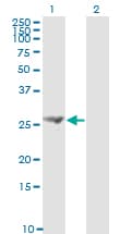FGF21 Antibody (clone 2F11)