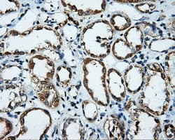 PLEK / Pleckstrin Antibody (clone OTI2F10)