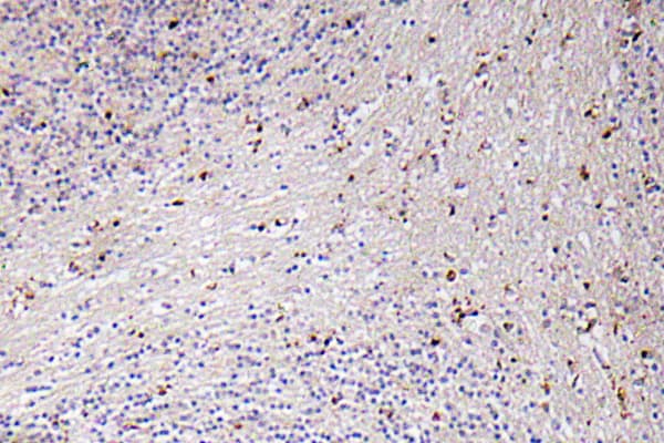 CXCL1 / GRO Alpha Antibody (Pro88)