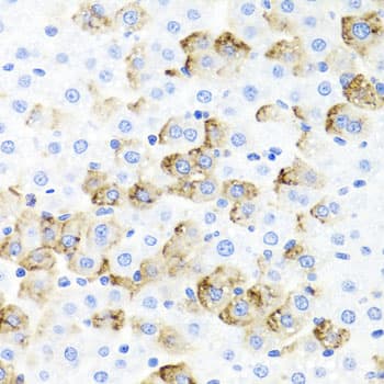 F3 / CD142 / Tissue factor Antibody