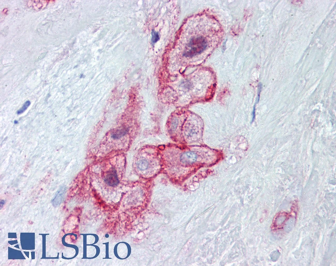 IHC-plus™ MCAM / CD146 Antibody (Tyr641)