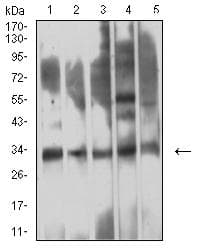 TREM1 Antibody (clone 6B12D1)