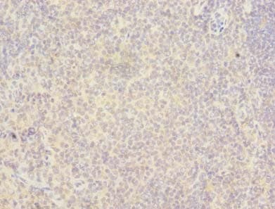 Polyclonal Rabbit anti-Human RAB6B Antibody (IHC, WB)