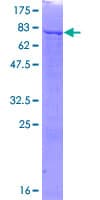 Human PPAT Protein (Recombinant GST)