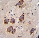 Polyclonal Rabbit anti-Human CACNG6 Antibody (aa108-136, IHC, IF, WB)