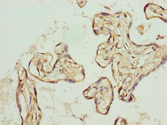 TRIP13 Antibody