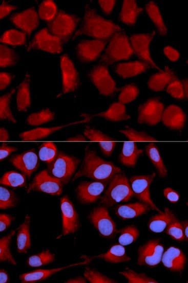 PDHA1 / PDH E1 Alpha Antibody