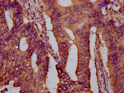 PTPN9 / MEG2 Antibody