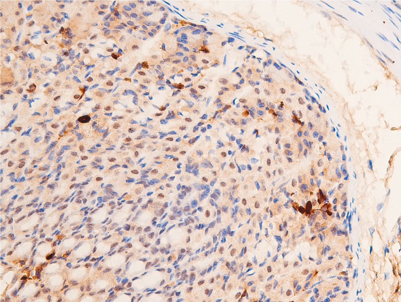 TP53 / p53 Antibody (Acetyl-Lys317)