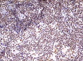 Monoclonal Mouse anti-Human CDCA7L Antibody (clone OTI1A12, aa1-337, IHC, WB)