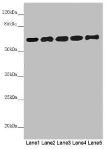 Polyclonal Rabbit anti-Human PACSIN2 Antibody (IHC, WB)