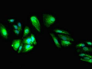 Polyclonal Rabbit anti-Human DEPDC1B Antibody (IHC, IF, WB)